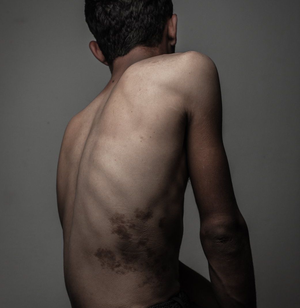 Syria what’s next? Meet Daniel Rye, Paul Conroy, White Helmets, Martin Thaulow, Refugee.Today and others.
